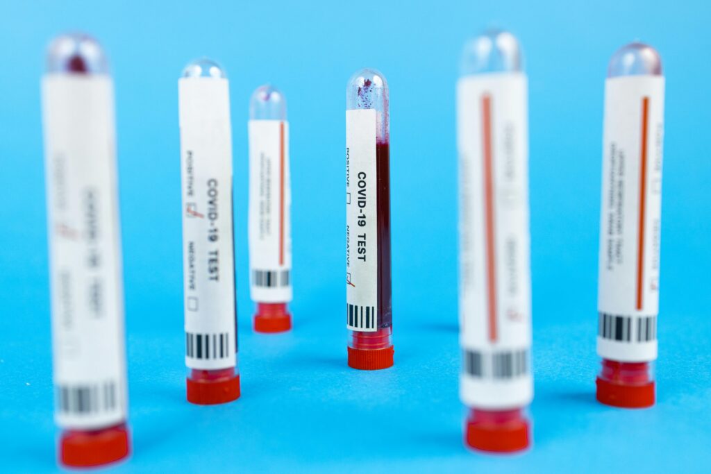 Close-up of COVID-19 blood test tubes on blue background, representing pandemic testing.